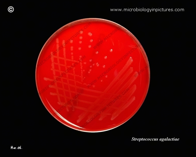 streptococcus agalactiae on sheep blood agar plate